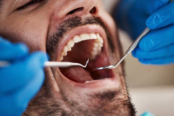 Best Weekend Emergency Dentist in Robbins, NC
