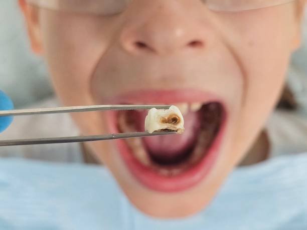 Best Emergency Cosmetic Dentistry in Robbins, NC