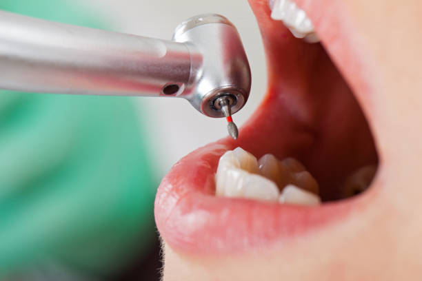 Best Urgent Dental Care for Toothache in Robbins, NC